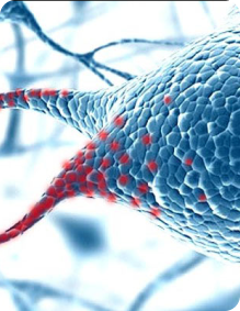 neurofocal